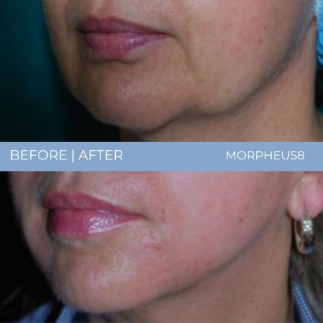 vrac-kosmetolog-big-4