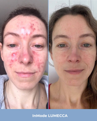 vrac-kosmetolog-big-3